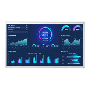 M&oacute;dulo de exibi&ccedil;&atilde;o LCD G156XW01 V101 AUO de 15,6 polegadas
